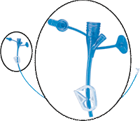MIC-KEY Non-Bolus Extension Set 12", DEHP-free