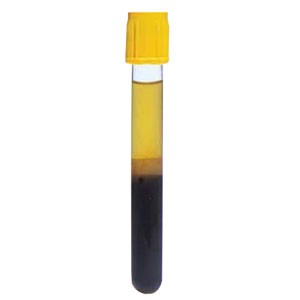 BD Vacutainer Tube, Gold BD Hemogard Closure, 13 x 100mm x 5.0mL