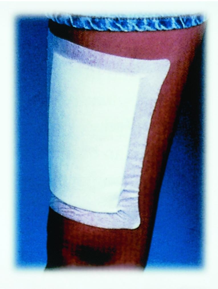 "Bordered Non-Sterile Gauze Dressing 6"" x 6"""