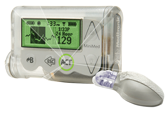MiniMed 530G with Enlite 551 Clear