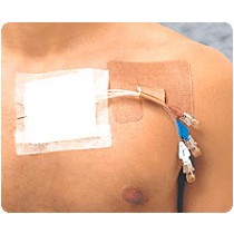Cath-Strip Reclosable Catheter Fastener