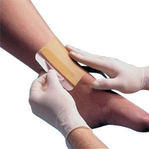 "Replicare Hydrocolloid Dressing, 6"" x 6"""