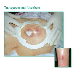 "Tegaderm Clear Absorbent Acrylic Dressing 5-9/10"" x 6"""