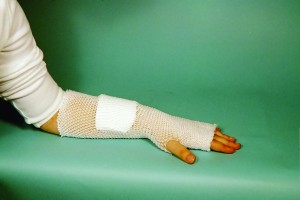 Cut-to-Fit MT Spandage, Size 3, 25 yds. (Medium Hand, Arm, Leg and Foot)