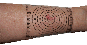 ReliaMed Disposable Wound Measurement Guide